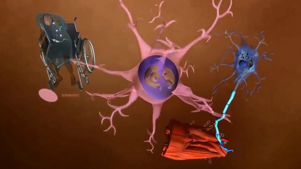 GSK Virtual Reality Medical ALS Visualization