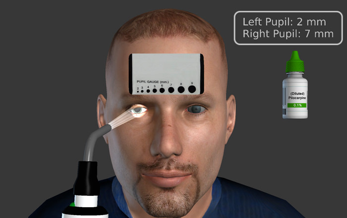 New Virtual Reality Application, EyeSim Advanced Pupil Simulator (APS), Helps Medical Students Become Proficient In Eye Exams